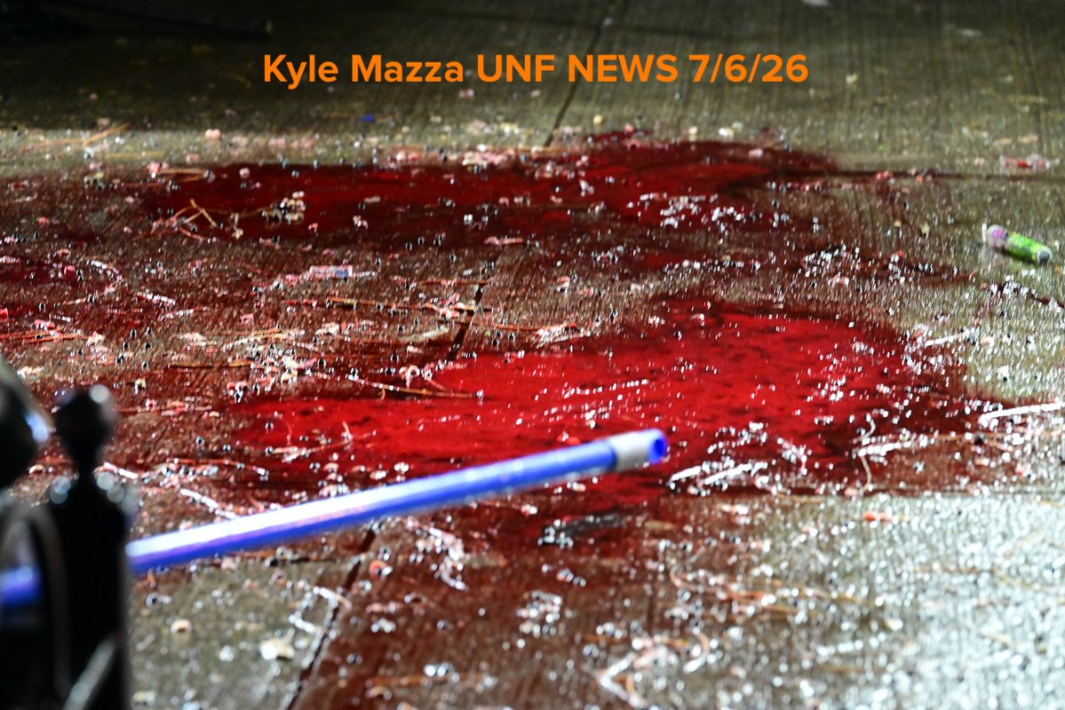 NYPD officers work the scene where a man was shot to the head in the area of White Plains Road and Archer Street in Bronx, New York, United States. The man who was shot to the head was rushed to a local area hospital and originally listed in critical condition. There are no arrests and the investigation is ongoing by the NYPD. A large pool of blood was found at the scene along with a shell casing.